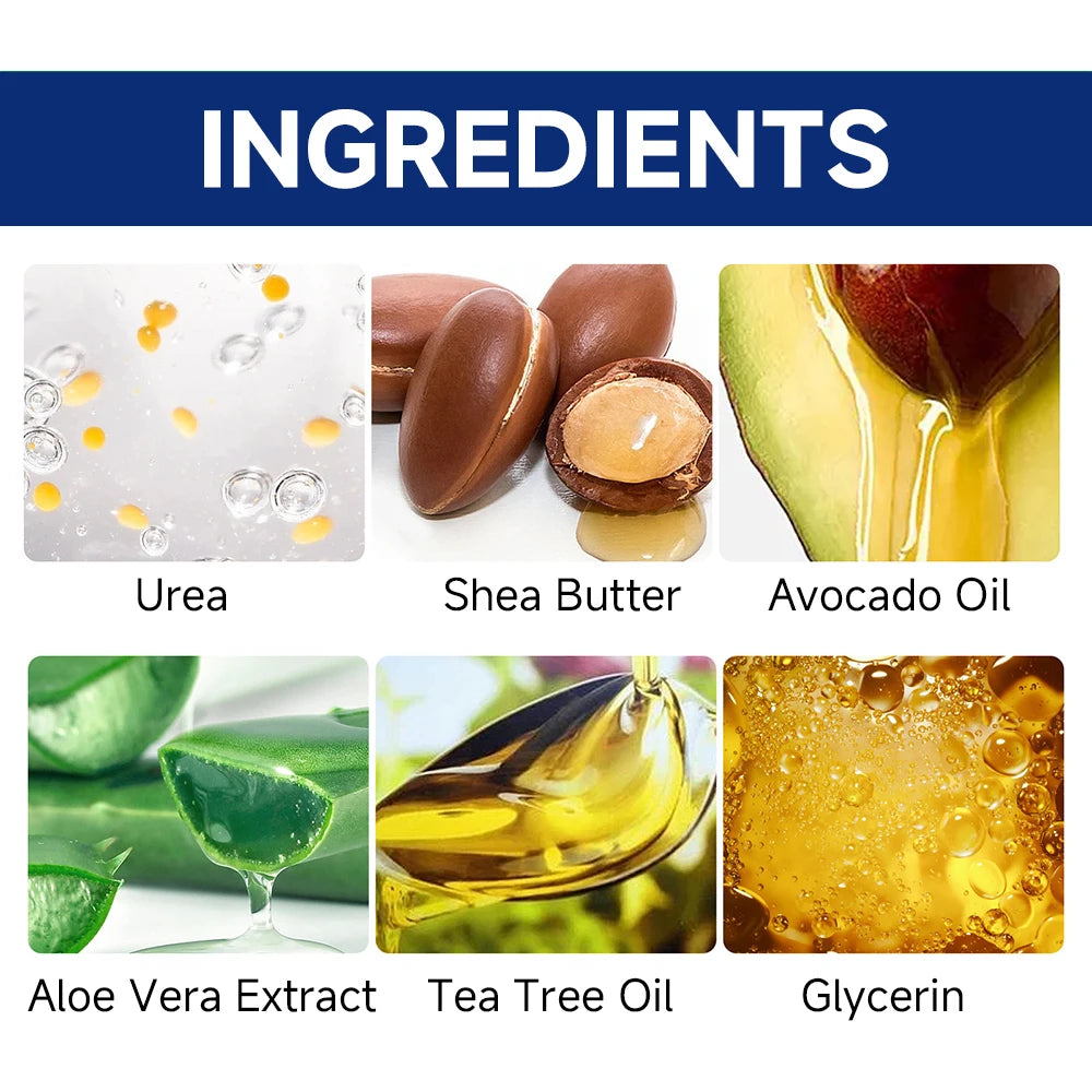 SUYARUN 60% Urea Foot Cream for Cracked Heels & Dry Skin - Intensive Moisturizing Treatment, Callus Remover, Diabetic Foot Care.